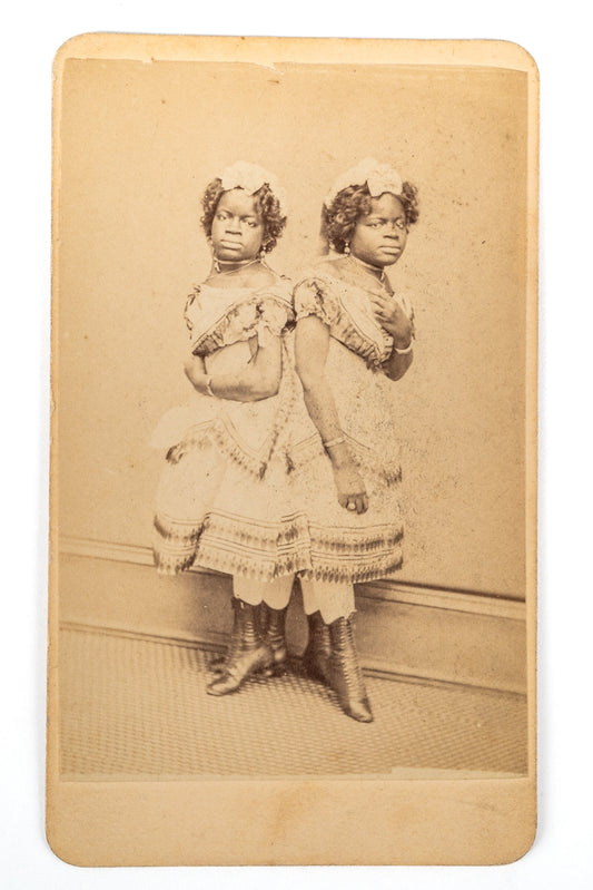 C1875 Rare CDV (Carte de Visite) Photograph,  Cojoined Twins